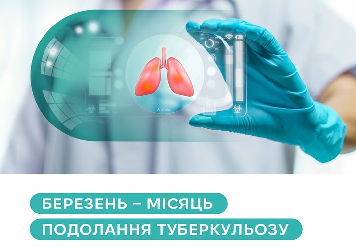 Вы сейчас просматриваете 
